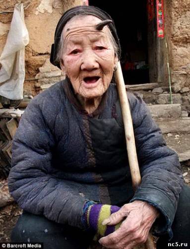 У 101-летней китаянки на лбу вырос рог S1010392